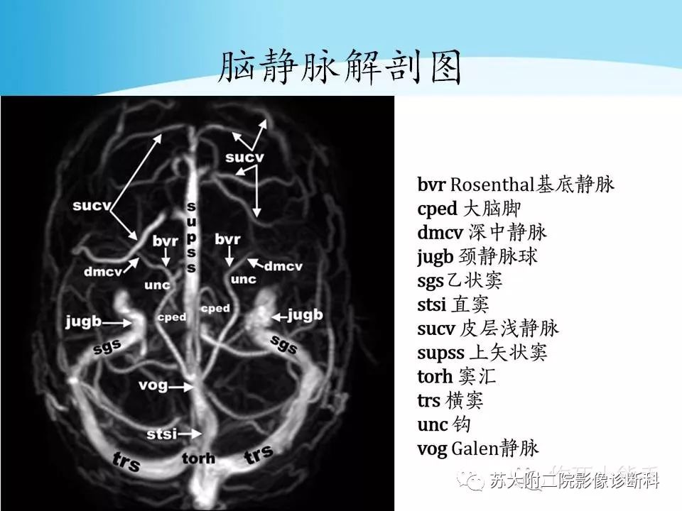 影像PPT - 【PPT】脑静脉血栓影像征象分析-12