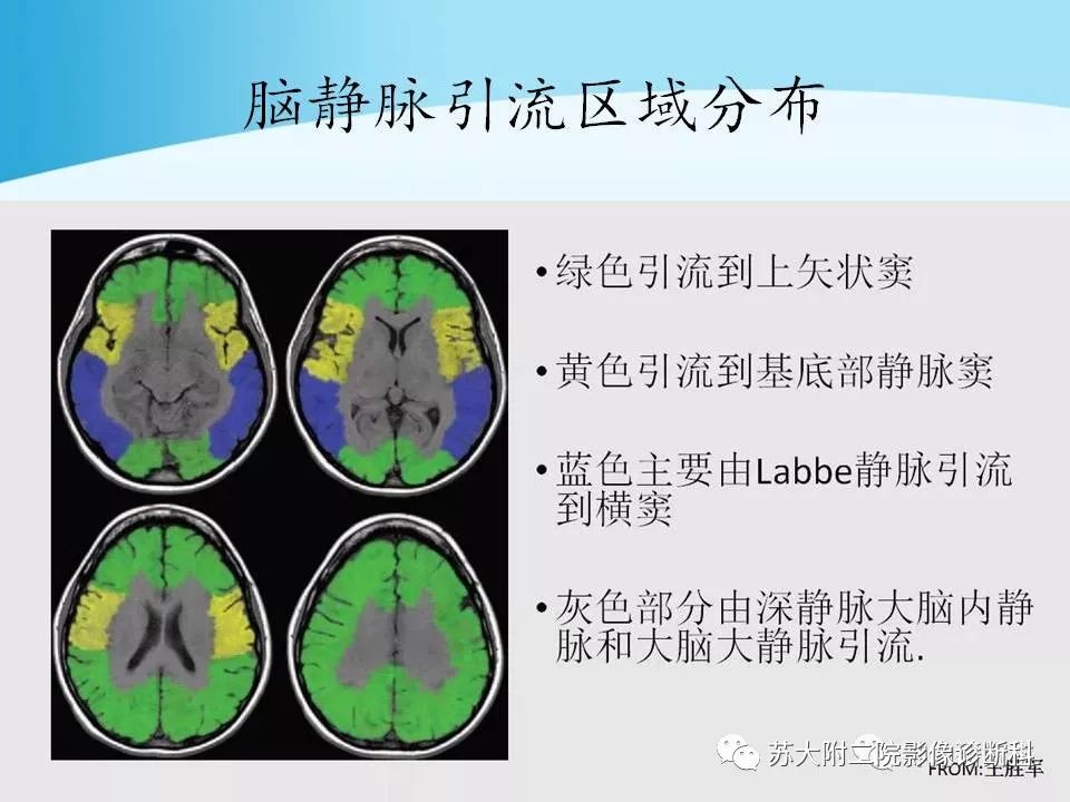 影像PPT - 【PPT】脑静脉血栓影像征象分析-13