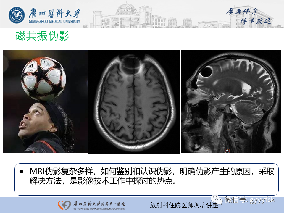 影像PPT - 【PPT】磁共振成像中的常见伪影及避免方法-3