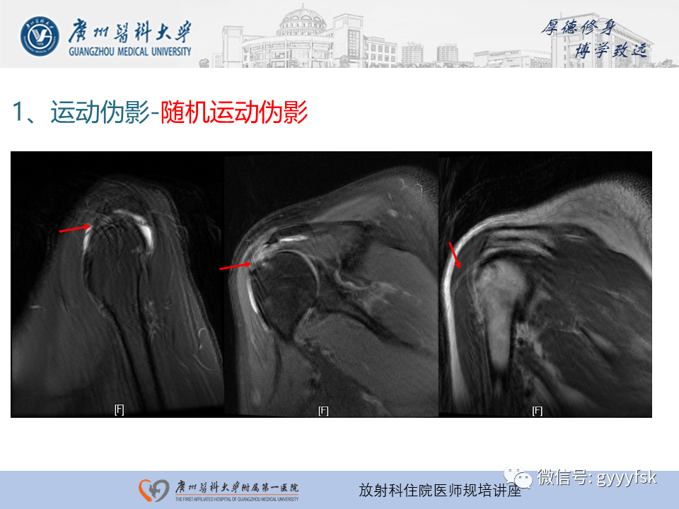 影像PPT - 【PPT】磁共振成像中的常见伪影及避免方法-8
