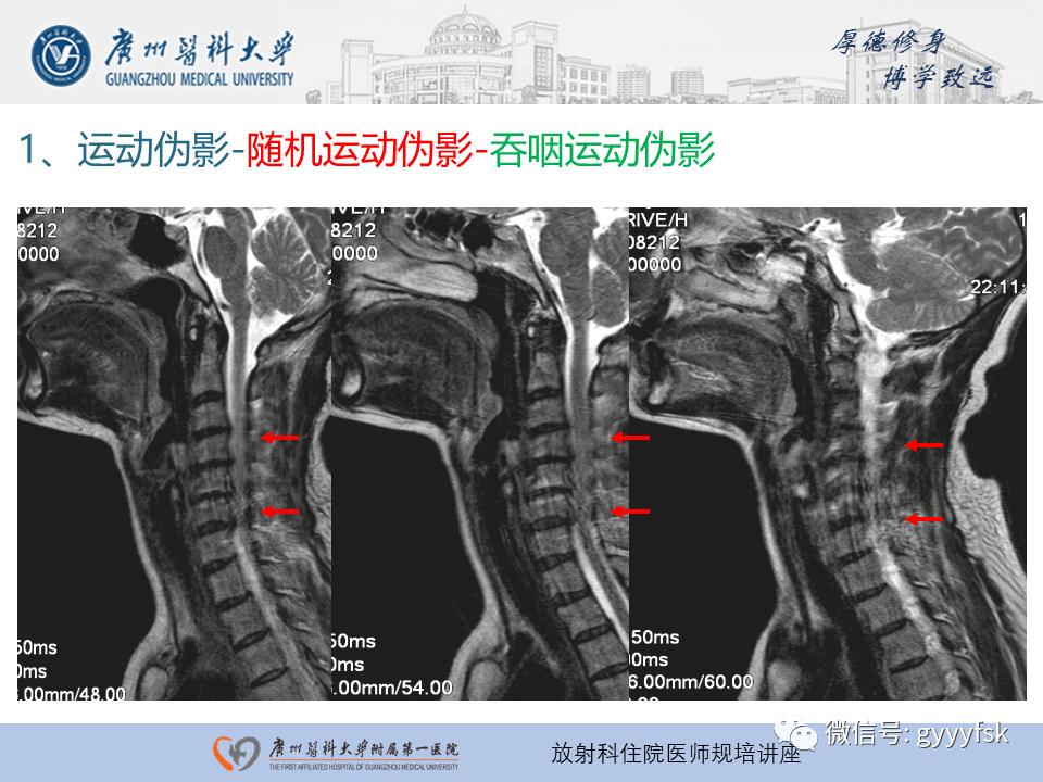 影像PPT - 【PPT】磁共振成像中的常见伪影及避免方法-9
