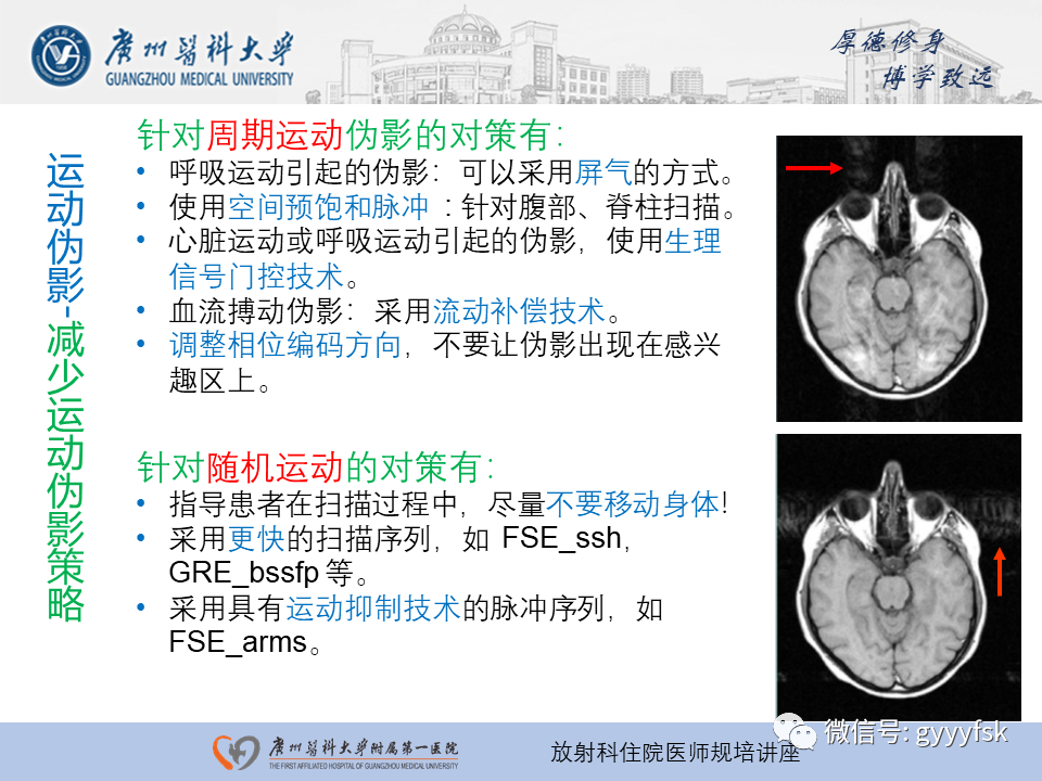 影像PPT - 【PPT】磁共振成像中的常见伪影及避免方法-16