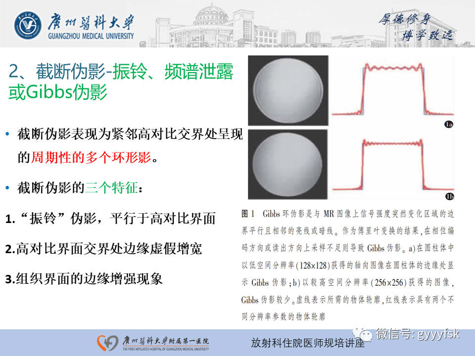 影像PPT - 【PPT】磁共振成像中的常见伪影及避免方法-18