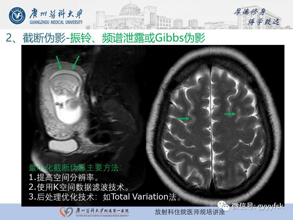 影像PPT - 【PPT】磁共振成像中的常见伪影及避免方法-19