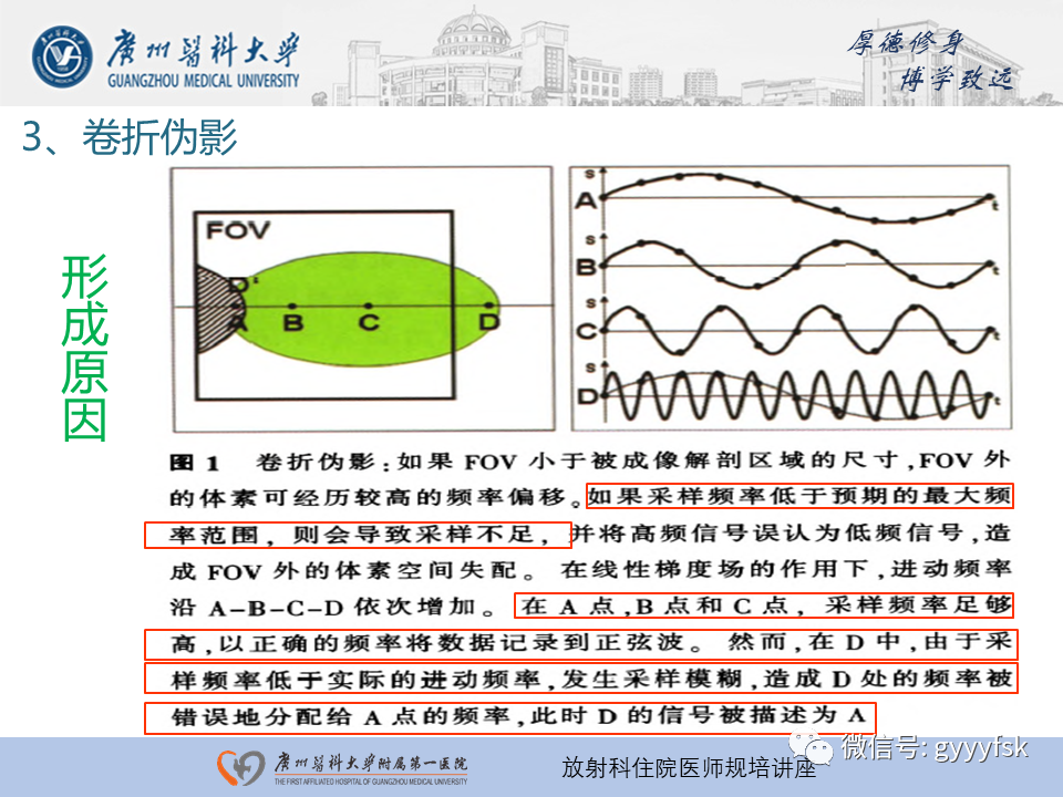 影像PPT - 【PPT】磁共振成像中的常见伪影及避免方法-20