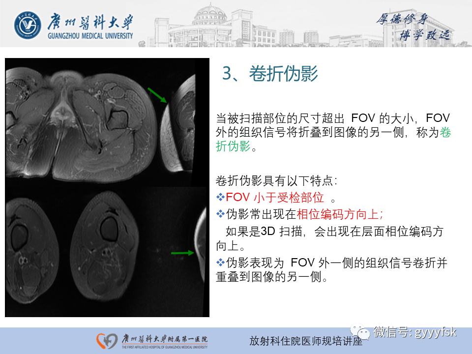 影像PPT - 【PPT】磁共振成像中的常见伪影及避免方法-21