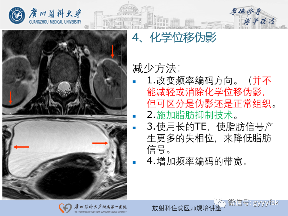 影像PPT - 【PPT】磁共振成像中的常见伪影及避免方法-24