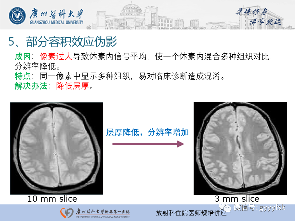影像PPT - 【PPT】磁共振成像中的常见伪影及避免方法-25