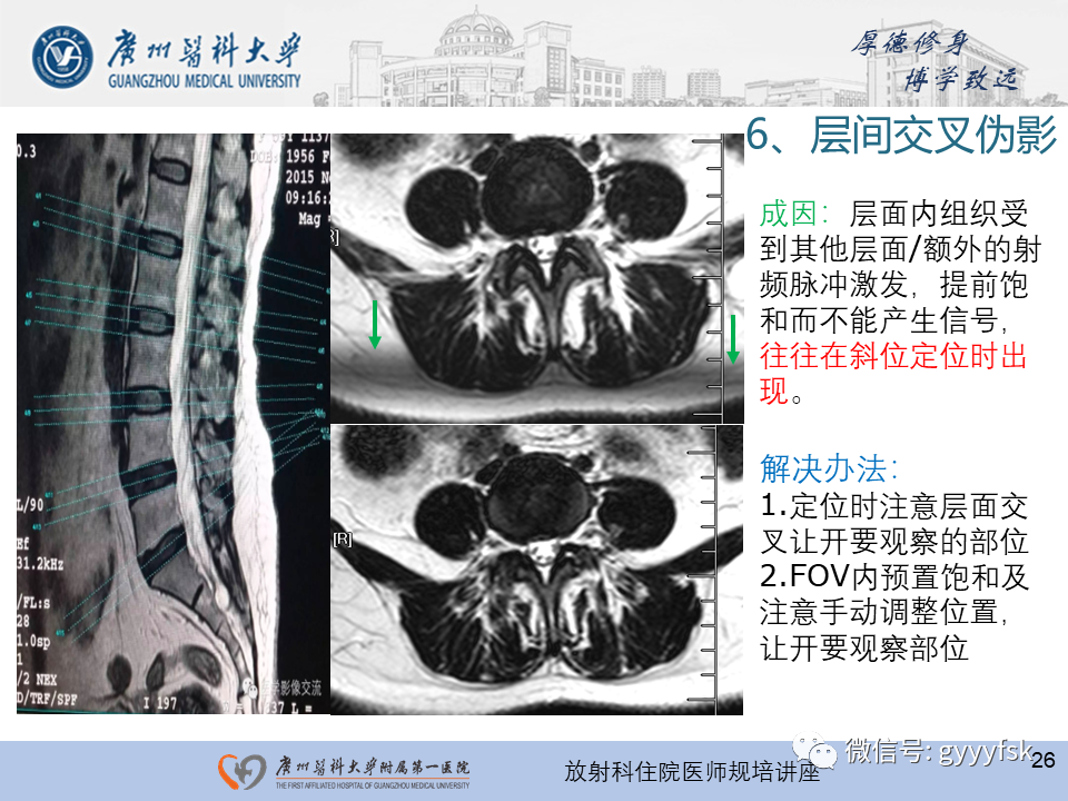 影像PPT - 【PPT】磁共振成像中的常见伪影及避免方法-26