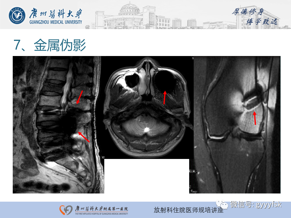 影像PPT - 【PPT】磁共振成像中的常见伪影及避免方法-28