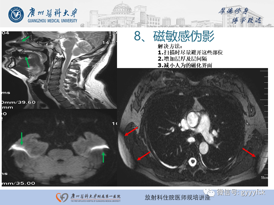 影像PPT - 【PPT】磁共振成像中的常见伪影及避免方法-31