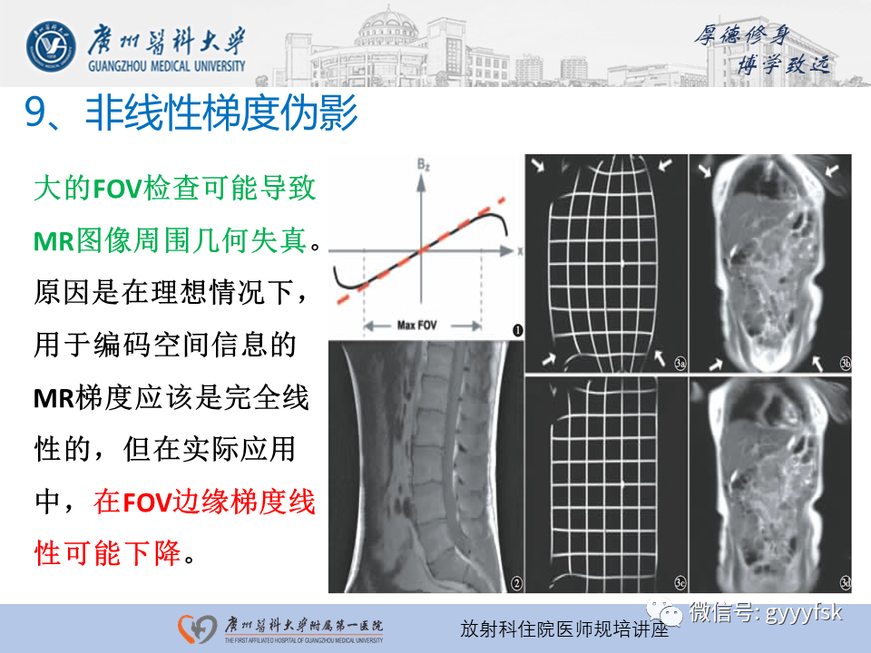 影像PPT - 【PPT】磁共振成像中的常见伪影及避免方法-32