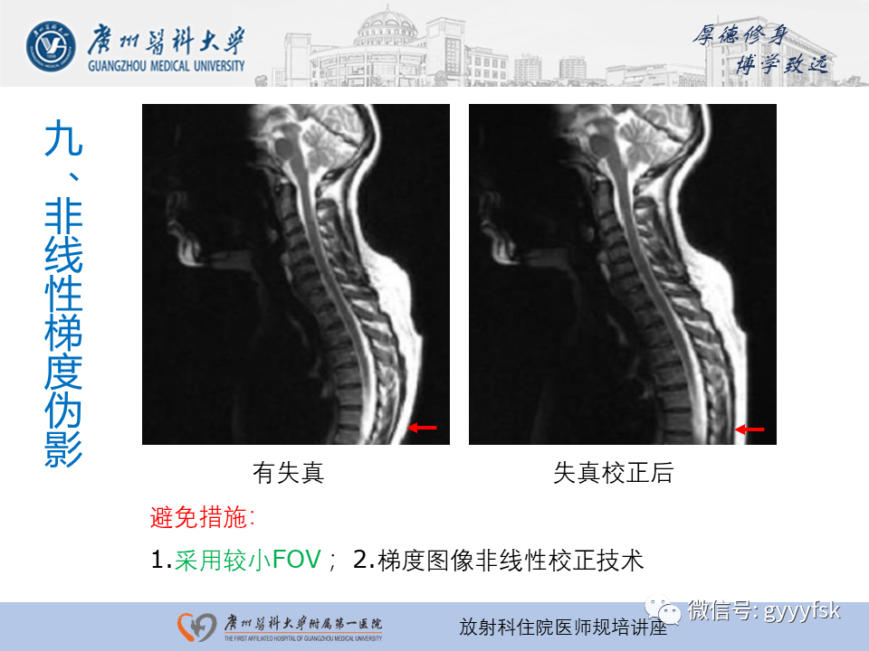 影像PPT - 【PPT】磁共振成像中的常见伪影及避免方法-33