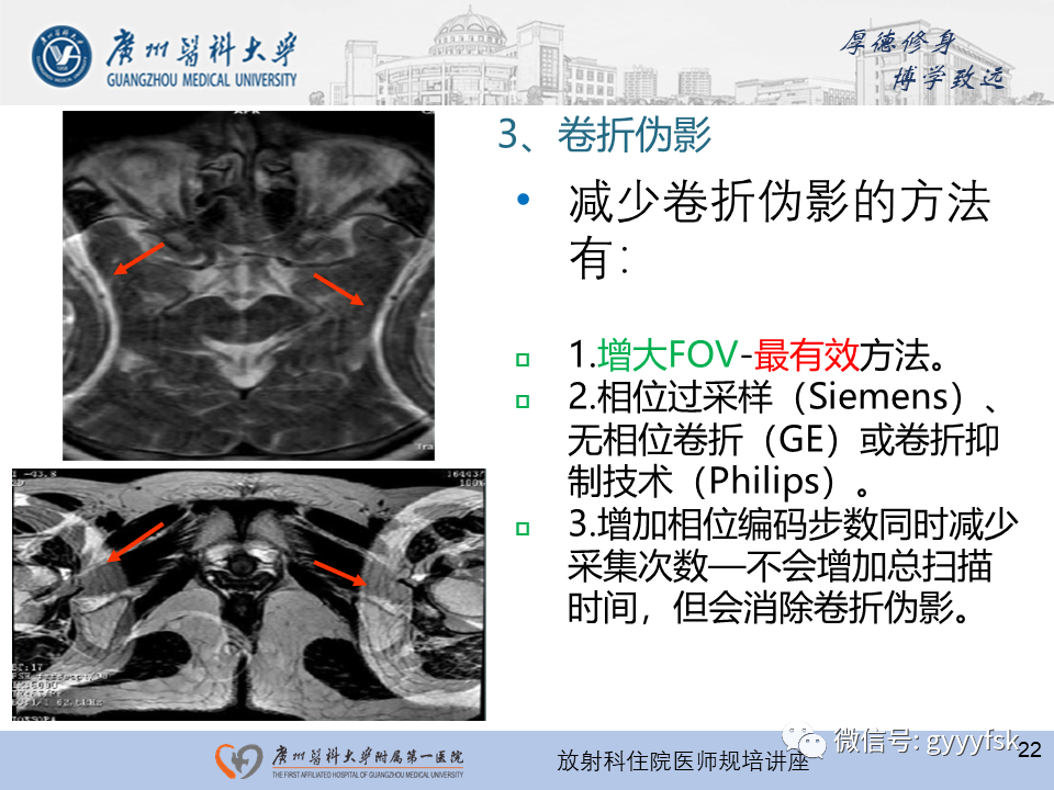影像PPT - 【PPT】磁共振成像中的常见伪影及避免方法-5
