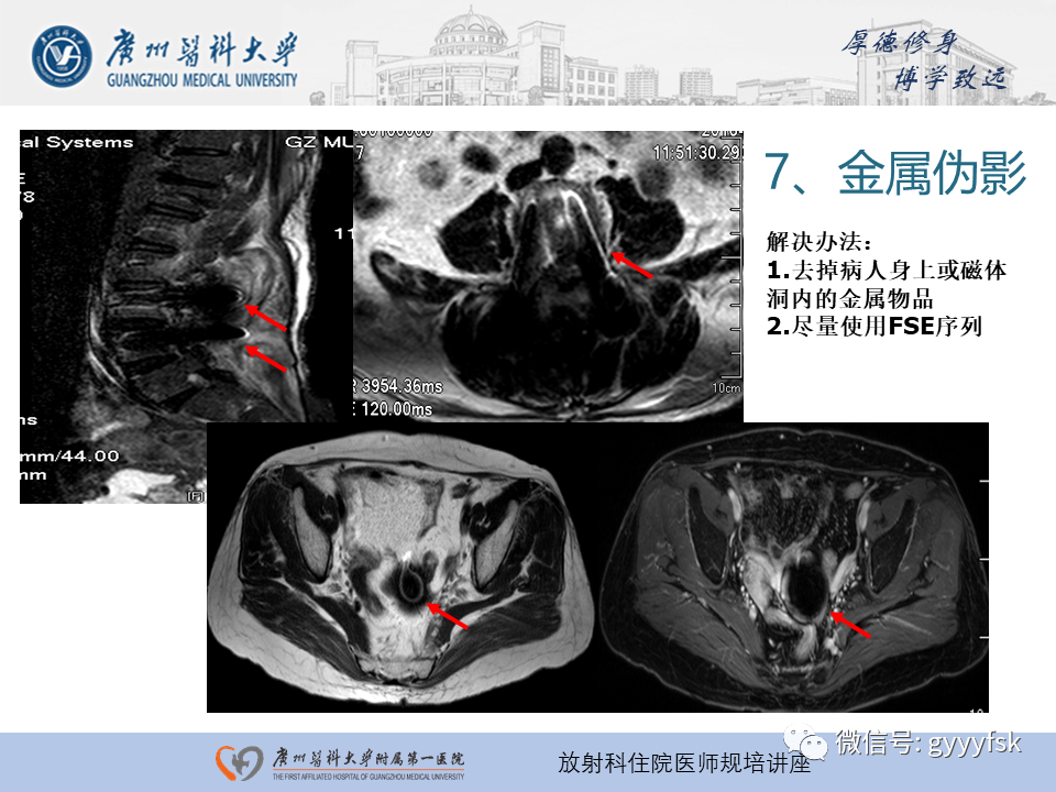 影像PPT - 【PPT】磁共振成像中的常见伪影及避免方法-6