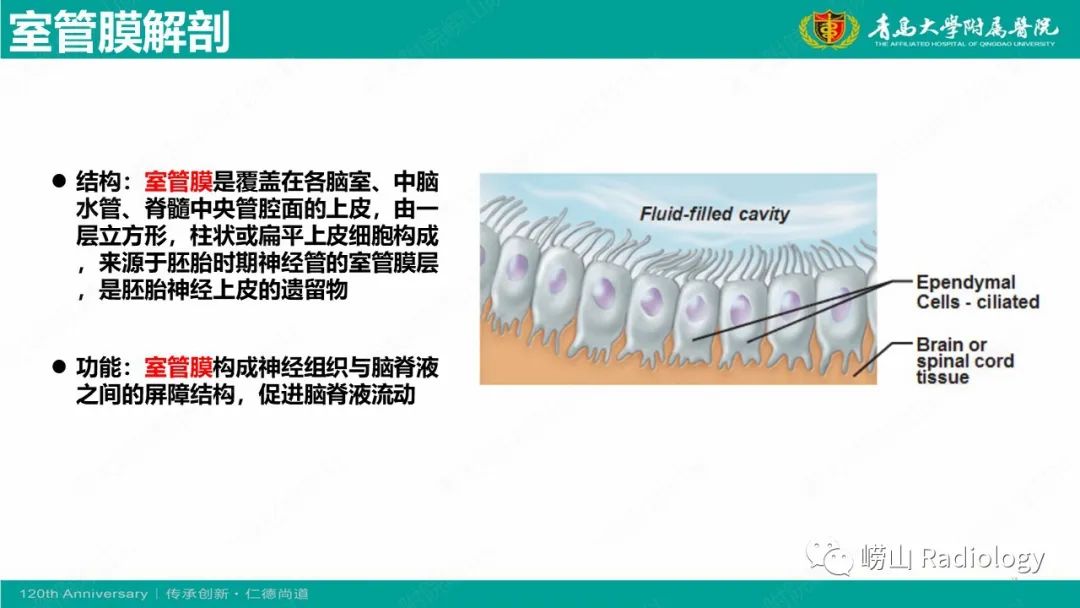 影像PPT - 【病例】桥小脑角区乳头型室管膜瘤1例CT及MR影像-13