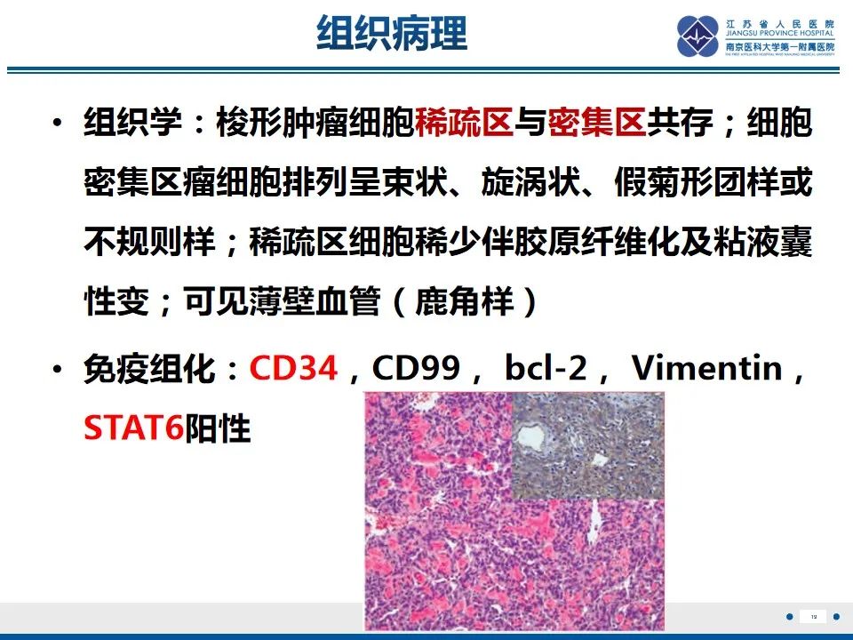 影像PPT - 【PPT】盆腔孤立性纤维瘤-20