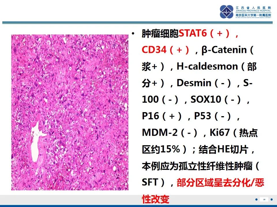 影像PPT - 【PPT】盆腔孤立性纤维瘤-26