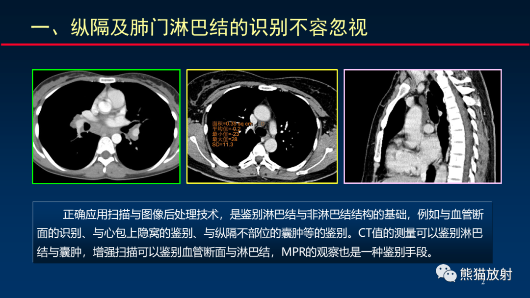 影像PPT - 【PPT】纵隔与肺门淋巴结的识别与精准CT分区-2