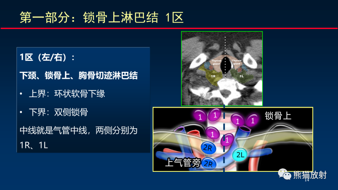 影像PPT - 【PPT】纵隔与肺门淋巴结的识别与精准CT分区-14