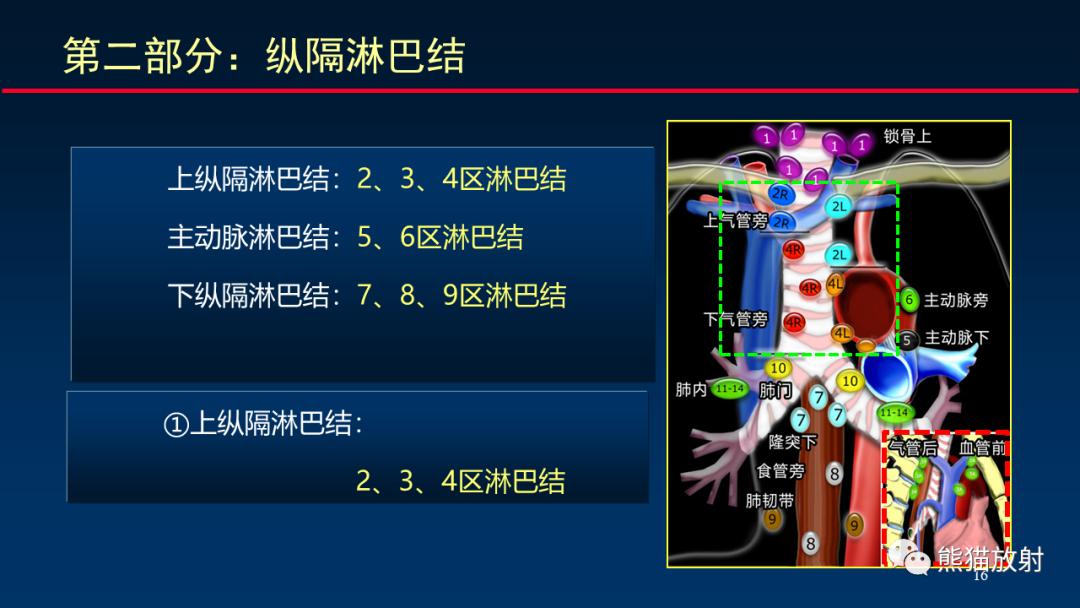 影像PPT - 【PPT】纵隔与肺门淋巴结的识别与精准CT分区-16