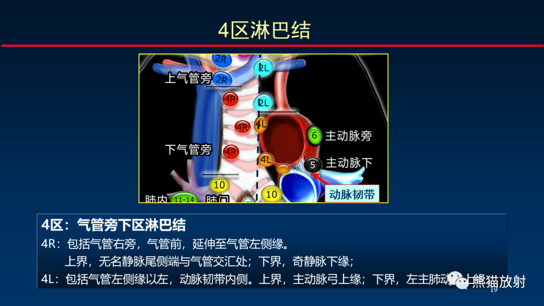 影像PPT - 【PPT】纵隔与肺门淋巴结的识别与精准CT分区-19