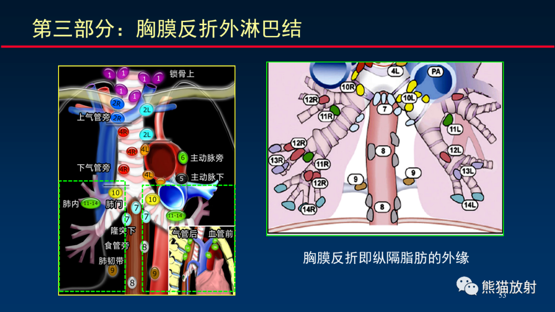 影像PPT - 【PPT】纵隔与肺门淋巴结的识别与精准CT分区-53