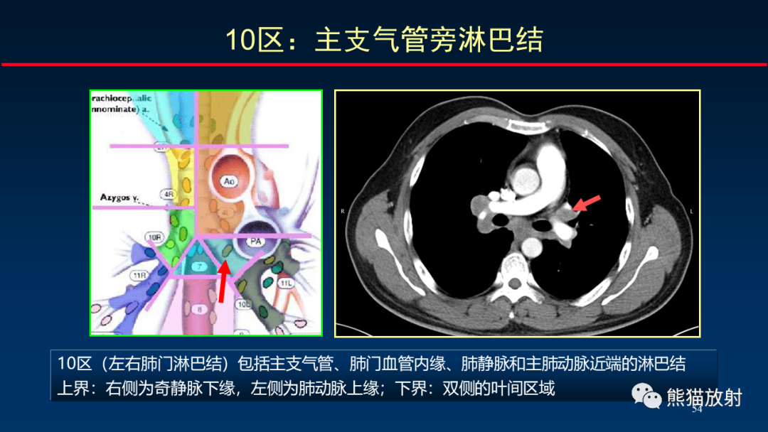 影像PPT - 【PPT】纵隔与肺门淋巴结的识别与精准CT分区-54