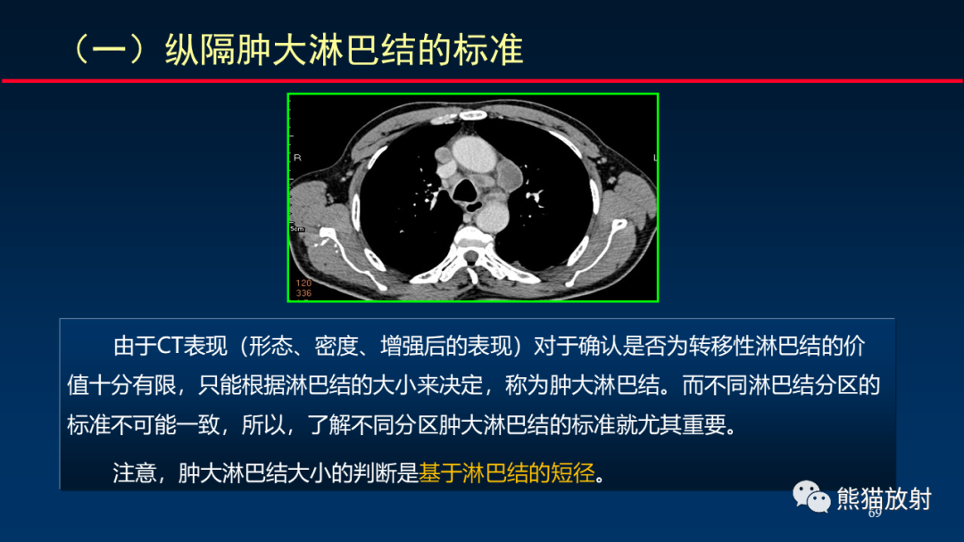 影像PPT - 【PPT】纵隔与肺门淋巴结的识别与精准CT分区-69