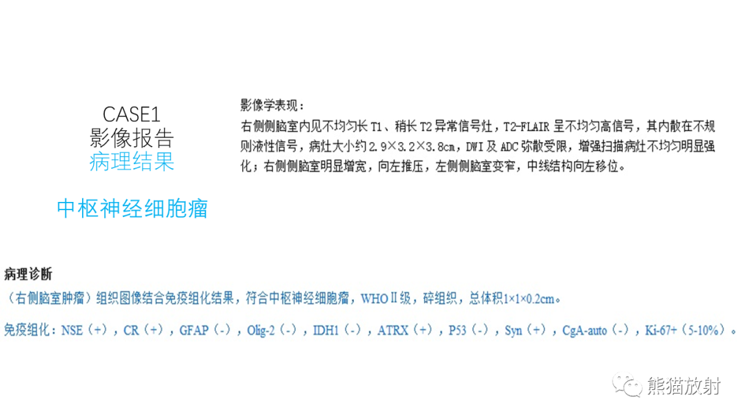 影像PPT - 【病例】中枢神经细胞瘤2例MR影像-13