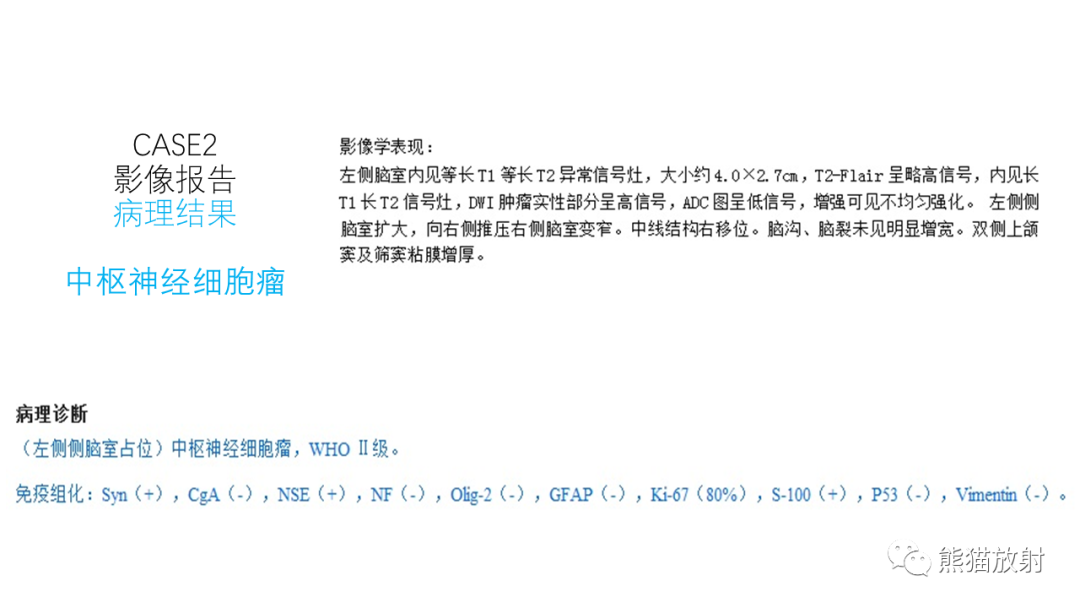影像PPT - 【病例】中枢神经细胞瘤2例MR影像-14