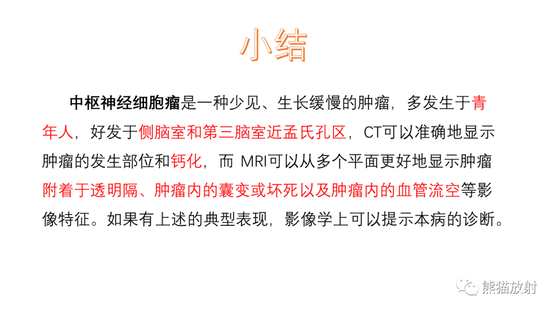 影像PPT - 【病例】中枢神经细胞瘤2例MR影像-33