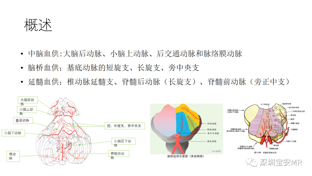 影像PPT - 【PPT】儿童脑干病变的MRI表现-3