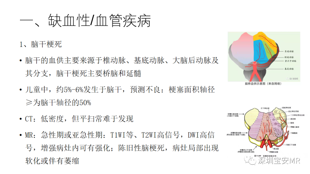 影像PPT - 【PPT】儿童脑干病变的MRI表现-5