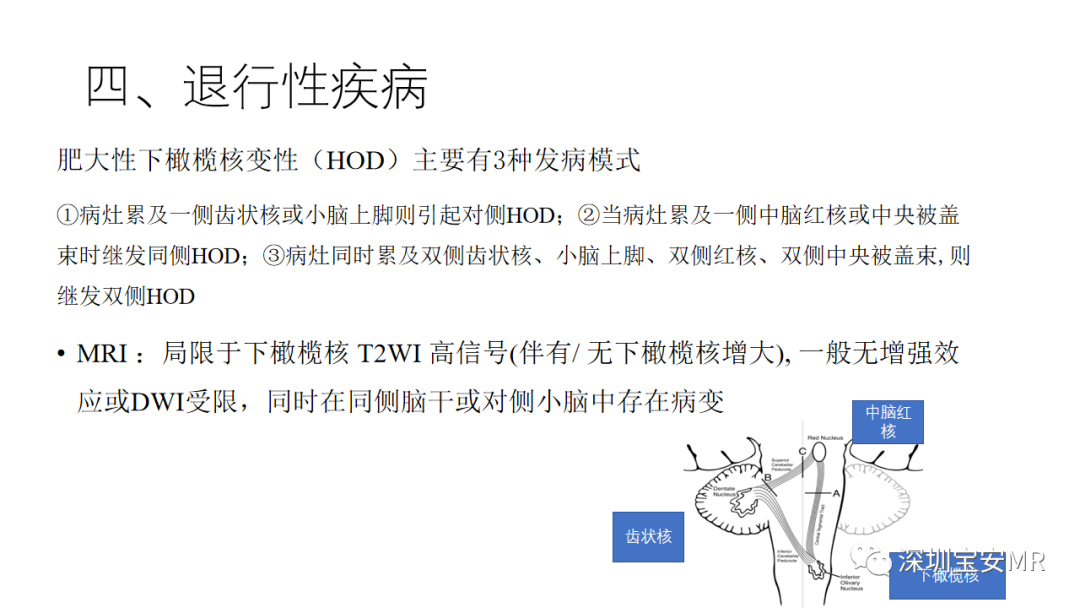 影像PPT - 【PPT】儿童脑干病变的MRI表现-27