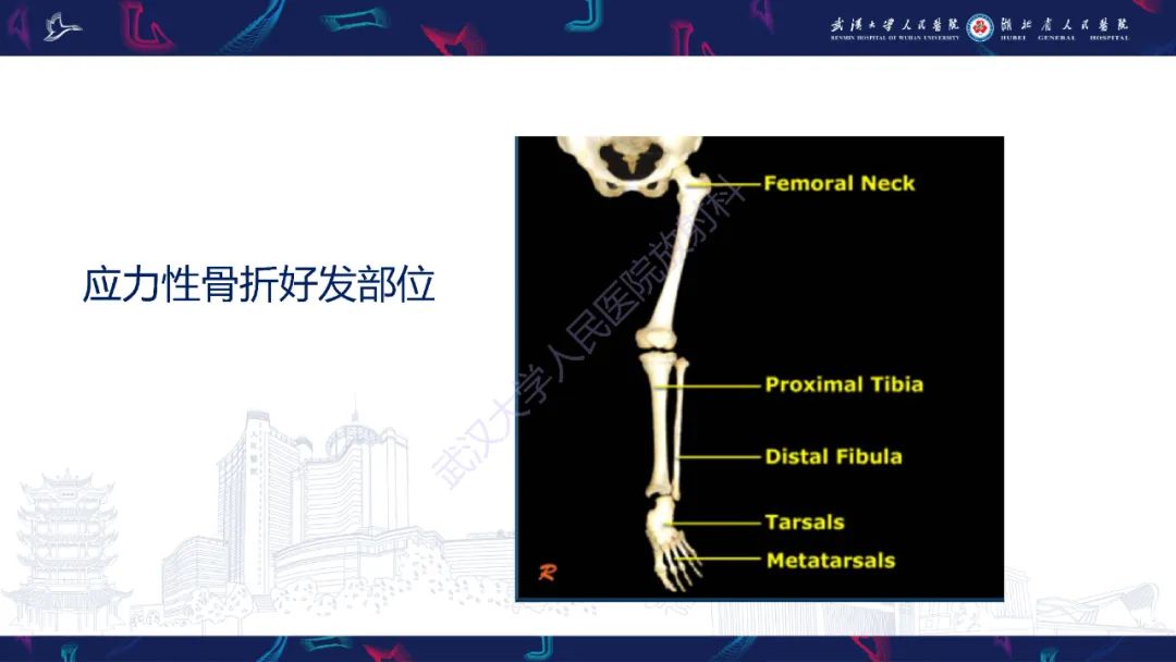 影像PPT - 一定要注意“可怕的黑线征”(dreaded black line)-9 影像PPT - 一定要注意“可怕的黑线征”(dreaded black line)-9