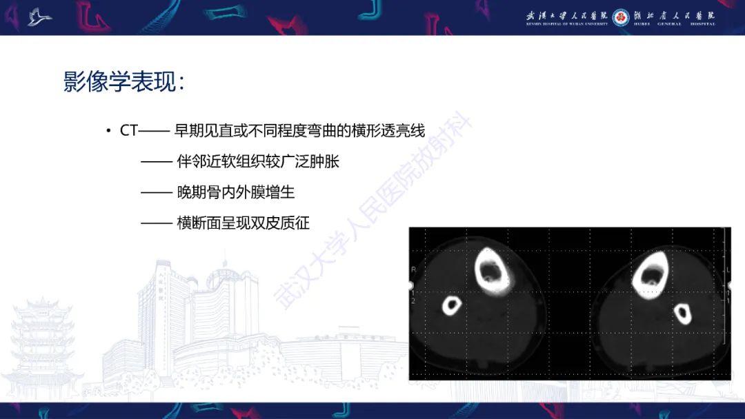 影像PPT - 一定要注意“可怕的黑线征”(dreaded black line)-15 影像PPT - 一定要注意“可怕的黑线征”(dreaded black line)-15