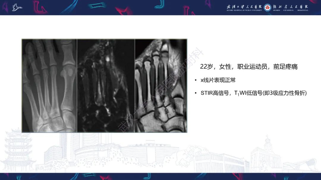 影像PPT - 一定要注意“可怕的黑线征”(dreaded black line)-18 影像PPT - 一定要注意“可怕的黑线征”(dreaded black line)-18