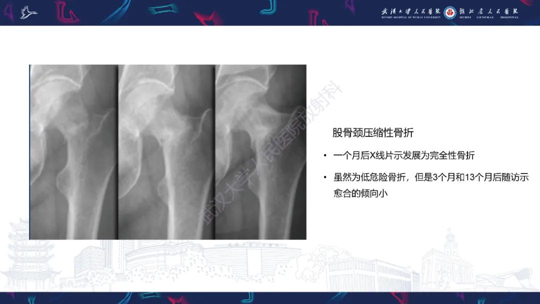 影像PPT - 一定要注意“可怕的黑线征”(dreaded black line)-22 影像PPT - 一定要注意“可怕的黑线征”(dreaded black line)-22