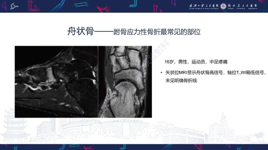影像PPT - 一定要注意“可怕的黑线征”(dreaded black line)-28 影像PPT - 一定要注意“可怕的黑线征”(dreaded black line)-28