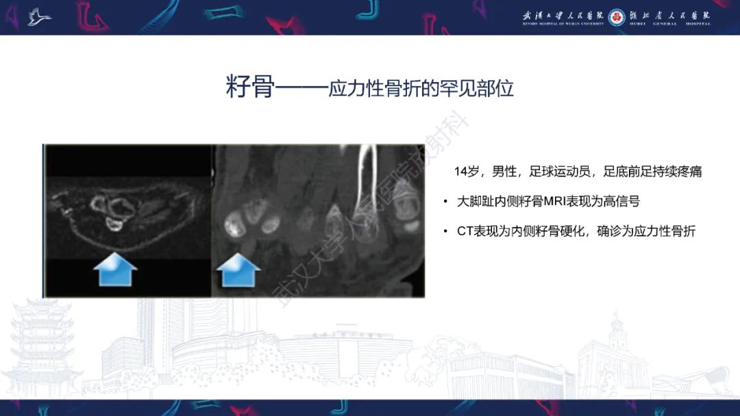 影像PPT - 一定要注意“可怕的黑线征”(dreaded black line)-32 影像PPT - 一定要注意“可怕的黑线征”(dreaded black line)-32