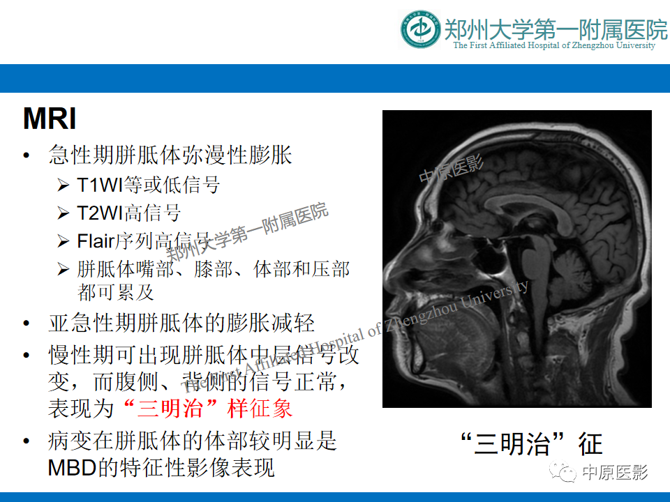 影像PPT - 【病例】酒精性胼胝体变性1例MR影像诊断-15