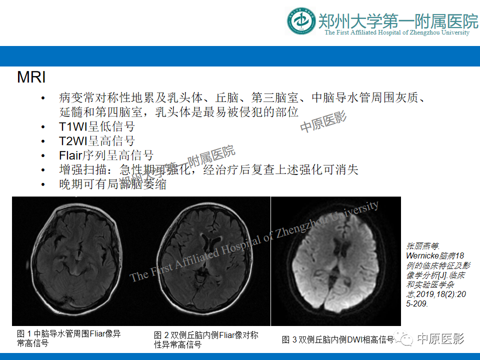影像PPT - 【病例】酒精性胼胝体变性1例MR影像诊断-17
