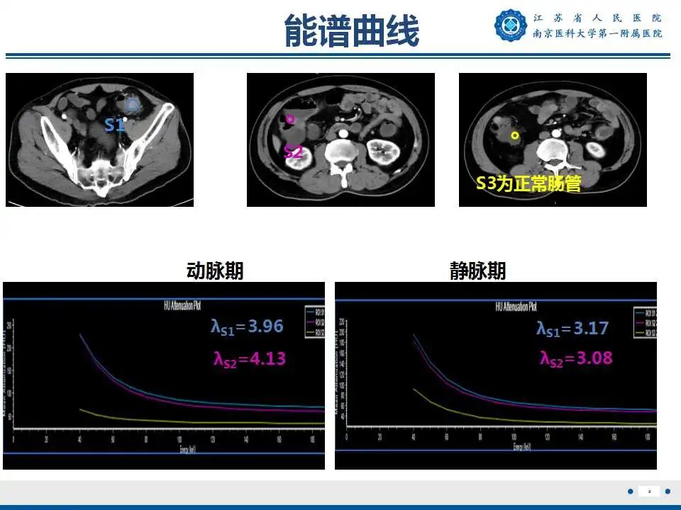 影像PPT - 【PPT】克罗恩病-9