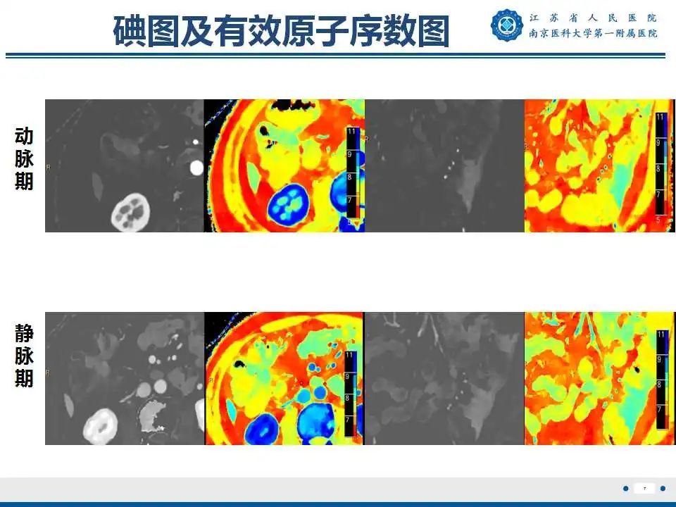 影像PPT - 【PPT】克罗恩病-8