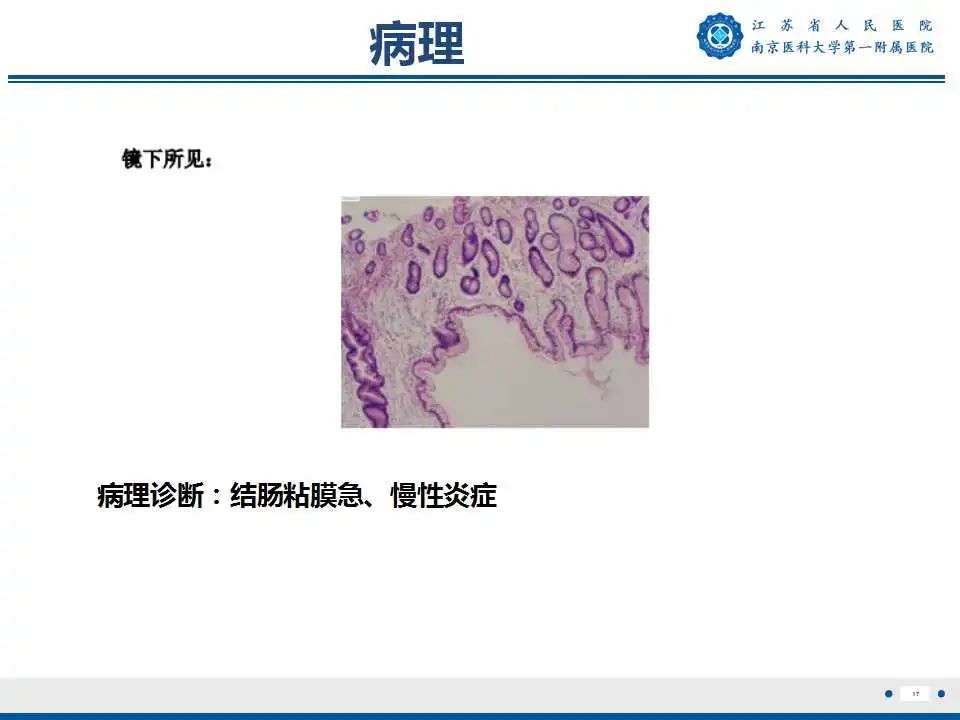 影像PPT - 【PPT】克罗恩病-18