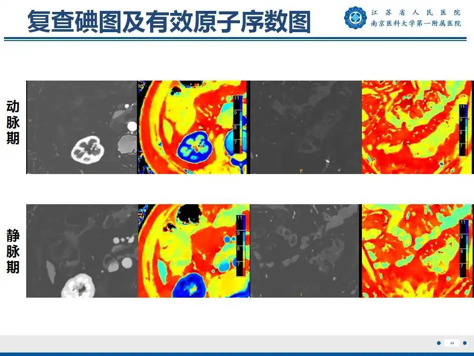 影像PPT - 【PPT】克罗恩病-21