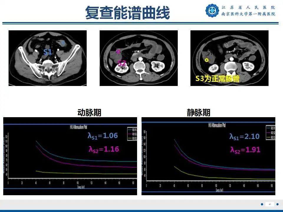 影像PPT - 【PPT】克罗恩病-22