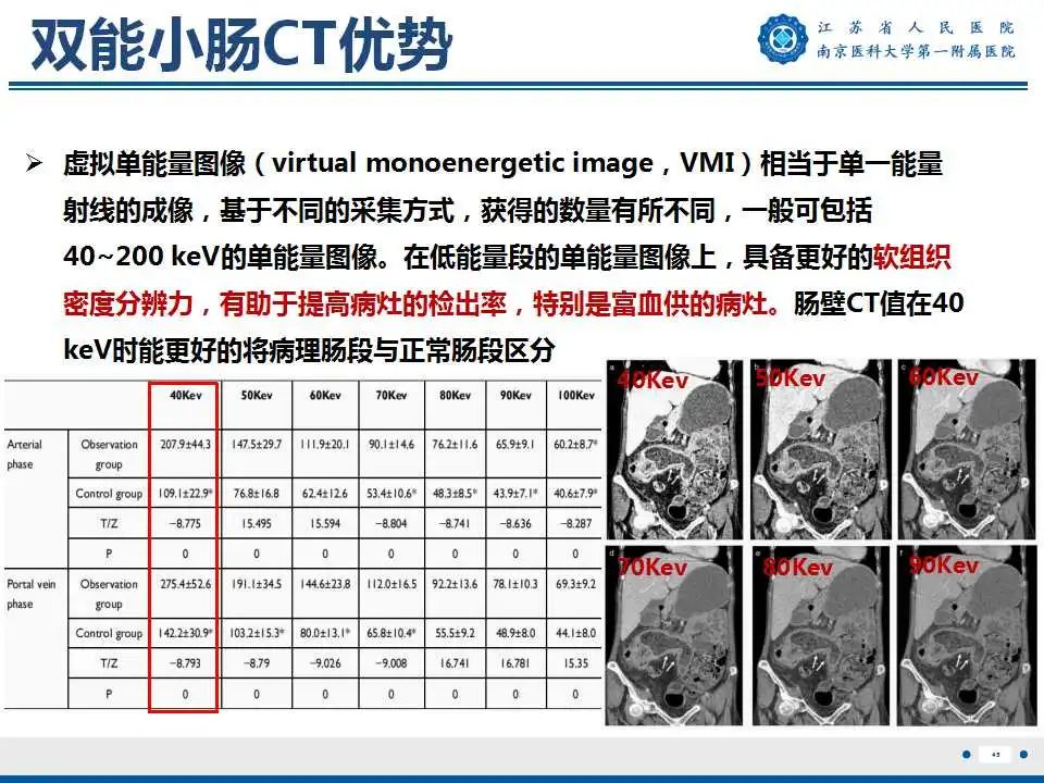 影像PPT - 【PPT】克罗恩病-46