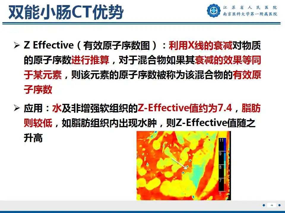 影像PPT - 【PPT】克罗恩病-49